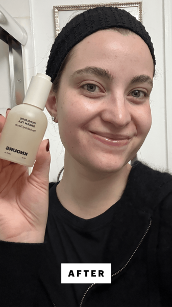 Felbin after applying the Knours PDRN Rice  Green Tea Revitalizing Serum